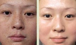 斑解内部爆料最新,揭秘行业背后惊人内幕